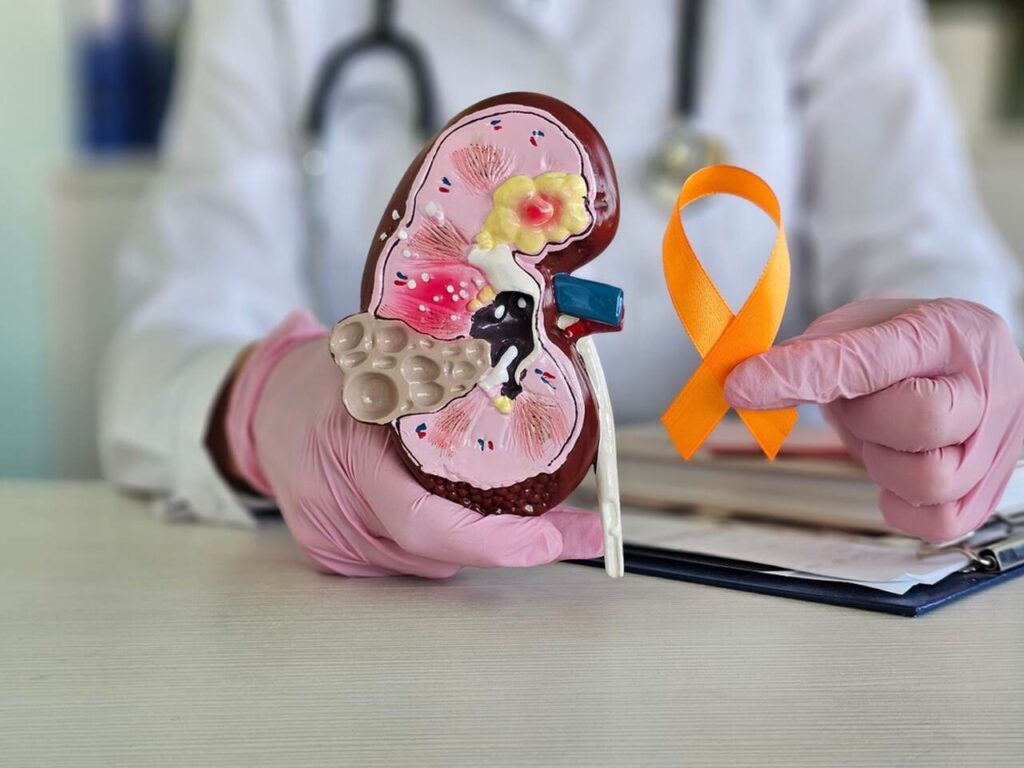 Médico sgurando rim com fita amarela